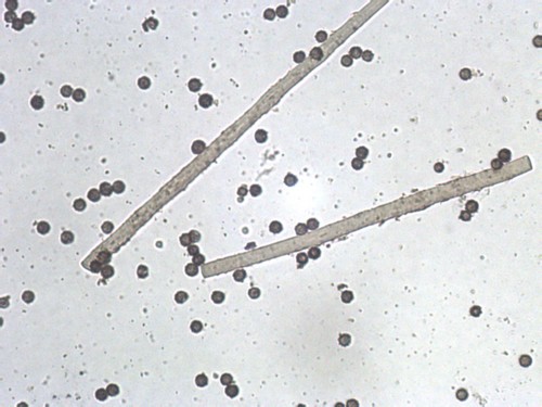 Trichaster (Photo 3 of 3)
