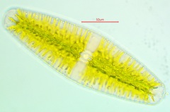 Netrium digitus