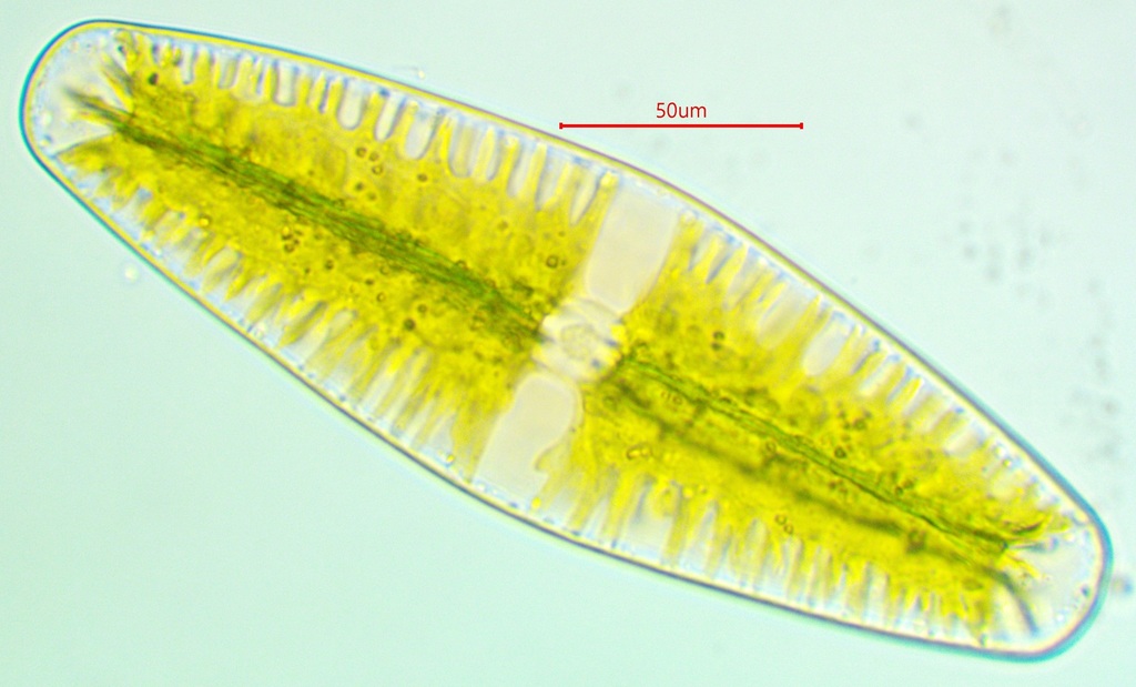 Netrium