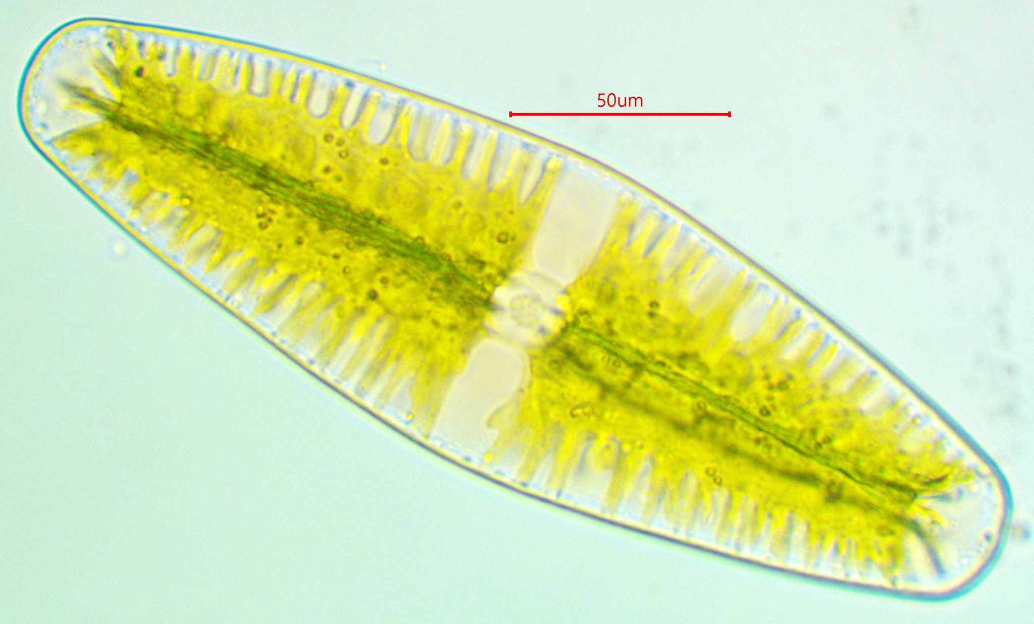 Netrium