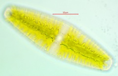Netrium digitus