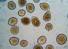 Sphaerosporium lignatile