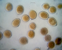 Sphaerosporium lignatile