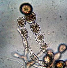 Sphaerosporium lignatile