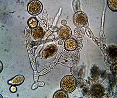 Sphaerosporium lignatile