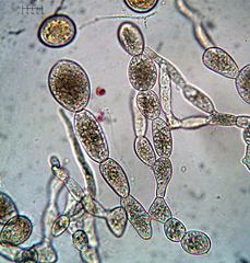 Sphaerosporium lignatile