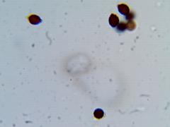 Lacrymaria lacrymabunda