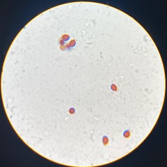 Lacrymaria lacrymabunda